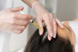 fluocinonide for scalp reviews hair loss