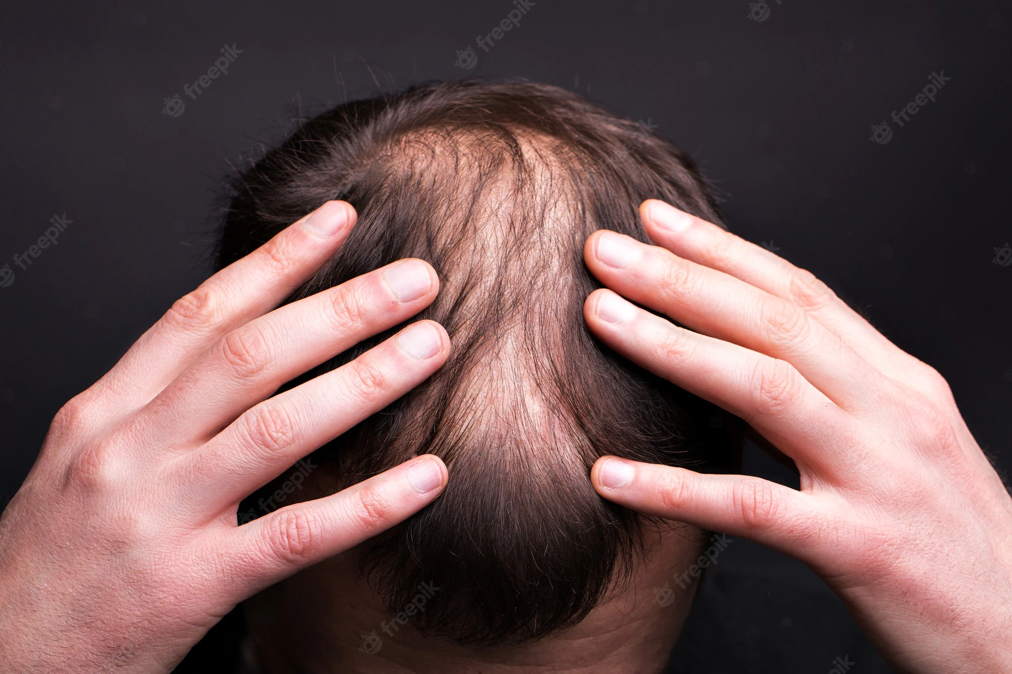 magnesium threonate hair loss
