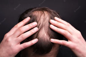 does kratom cause hair loss