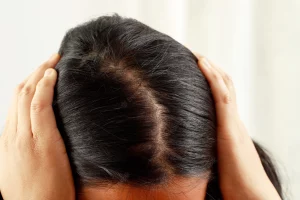 does maui shampoo and conditioner cause hair loss