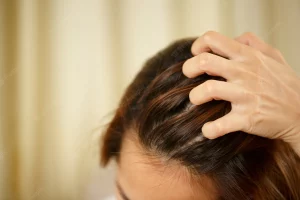 aussie shampoo review hair loss