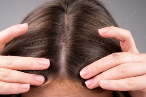 turkesterone hair loss